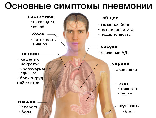 7 самых опасных мифов о пневмонии 7 самых опасных мифов о пневмонии